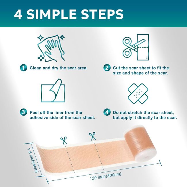 UNIEDI Narbenpflaster - 4cm x 300cm