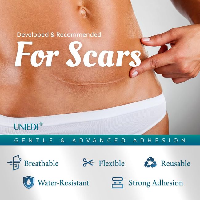 UNIEDI Narbenpflaster - 4cm x 300cm