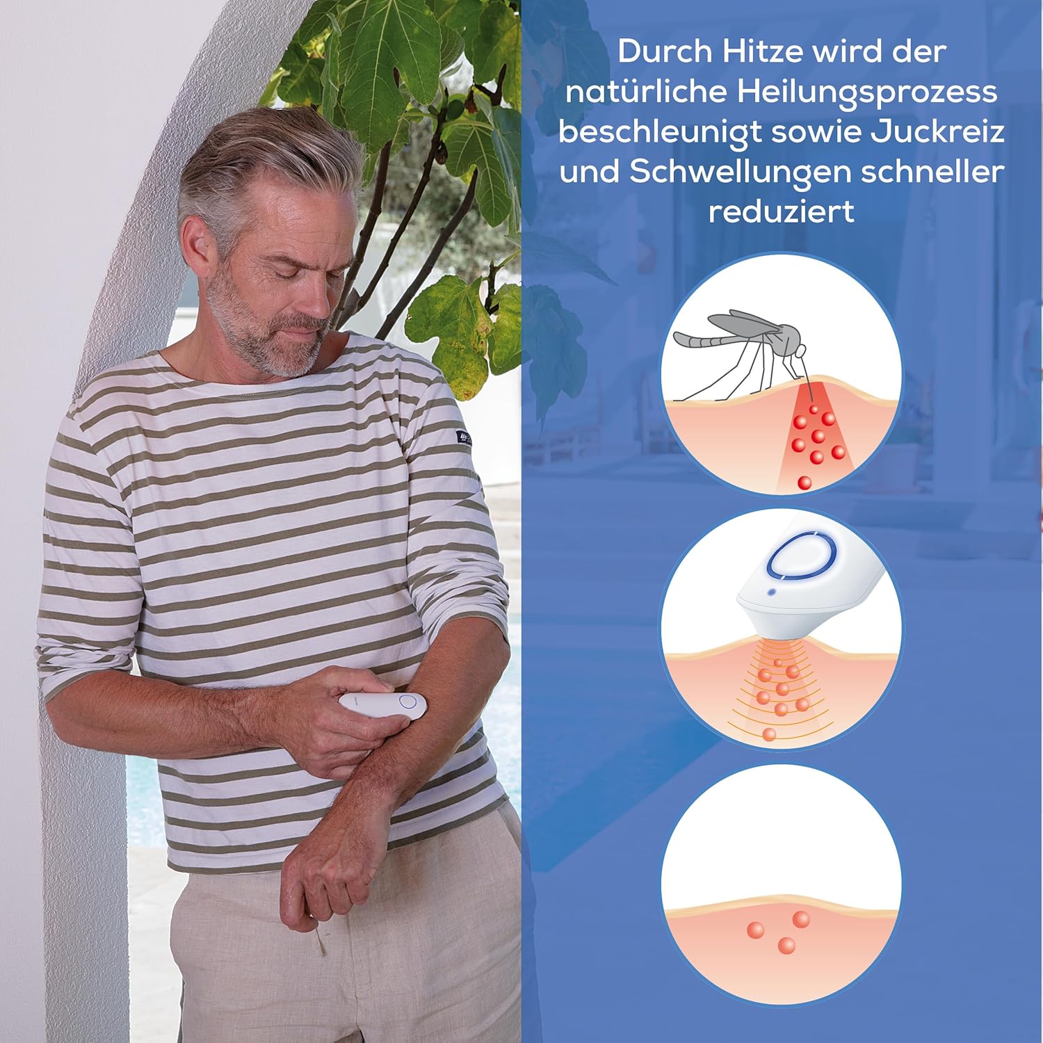 Beurer | Insektenstichheiler BR 60 zur Behandlung von Insektenstichen- und bissen, lindert Juckreiz