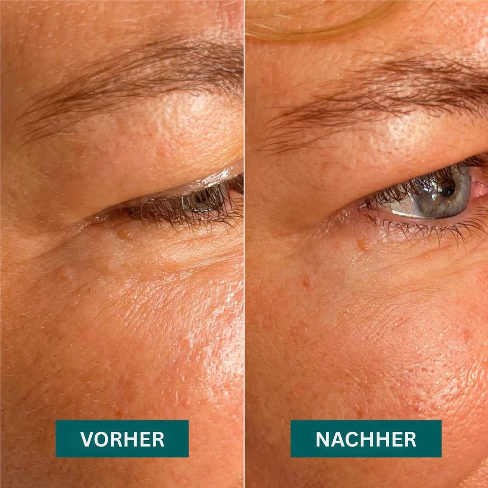 APRICOT | Augen-Schläfen Pads "aloe there" mit Aloe Vera - 30 Behandlungen