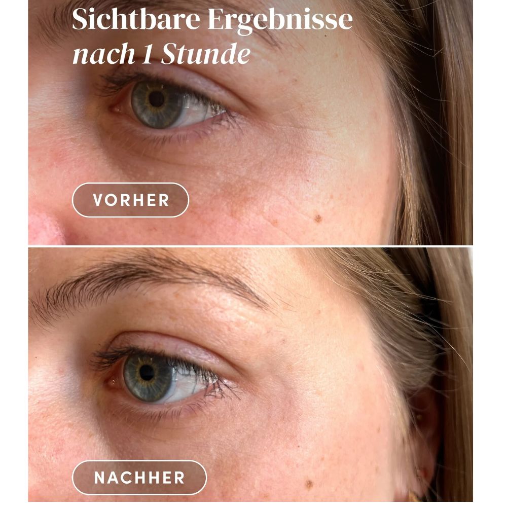 APRICOT | Wiederverwendbare Augen-Schläfen Pads mit Hexapeptid - 30 Behandlungen