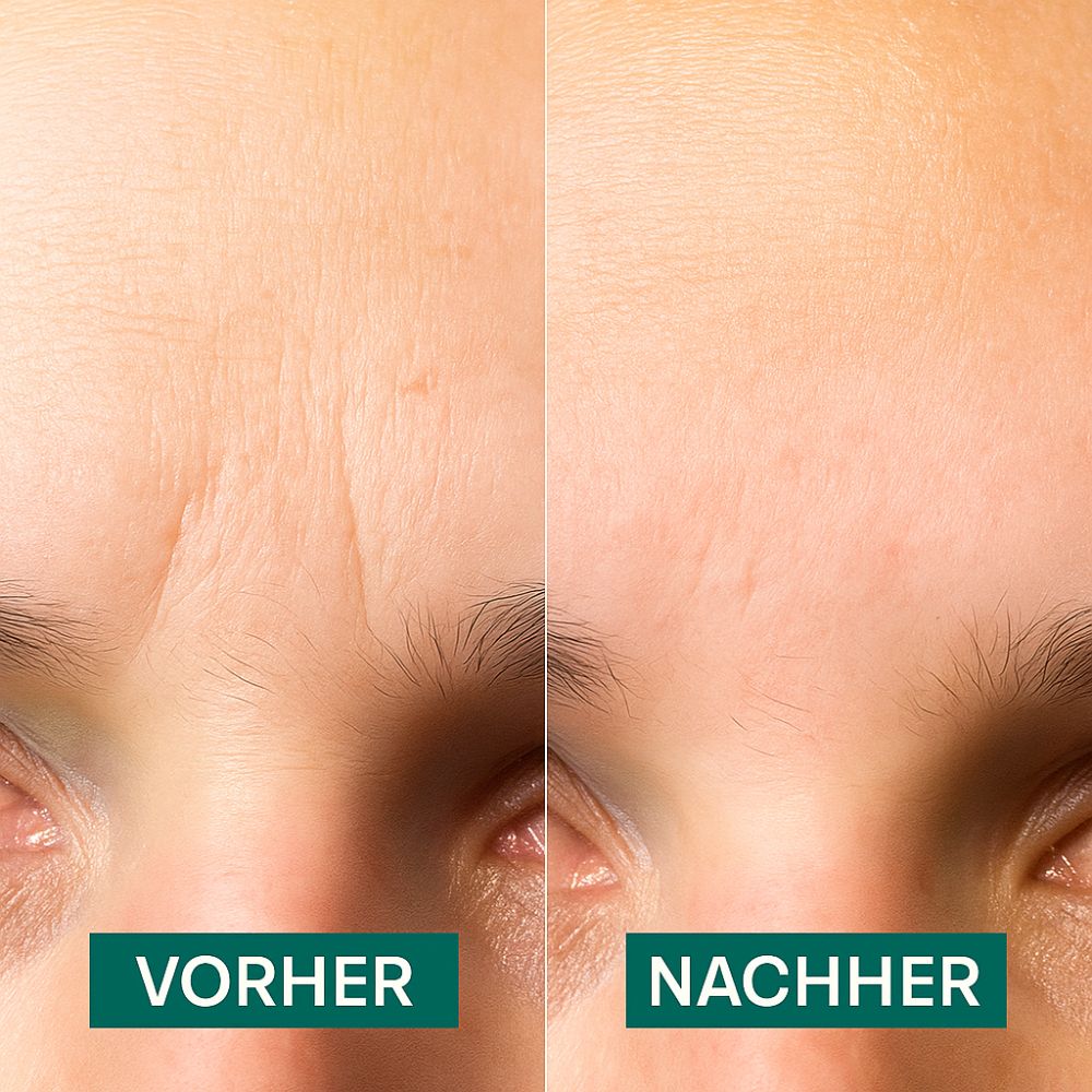 APRICOT I Zornesfalten Pads "face charmer" mit Ectoin - 100 Behandlungen