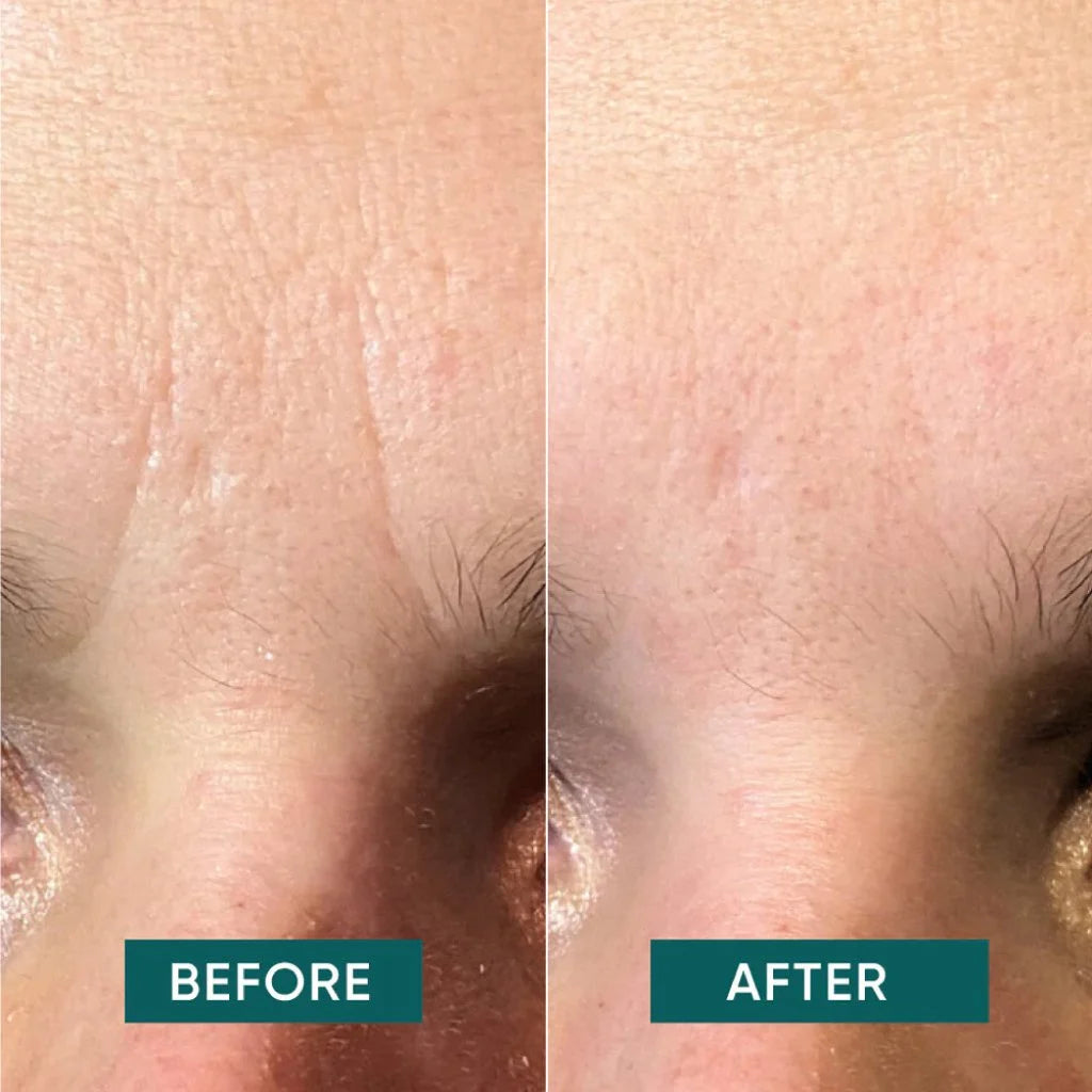 APRICOT I Gesichtspads mit Panthenol 100 Pink