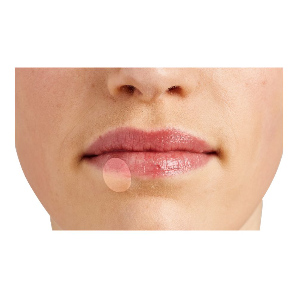 WUNDmed | Herpes Patch Hydrocolloid 15x15mm - 6 Stück