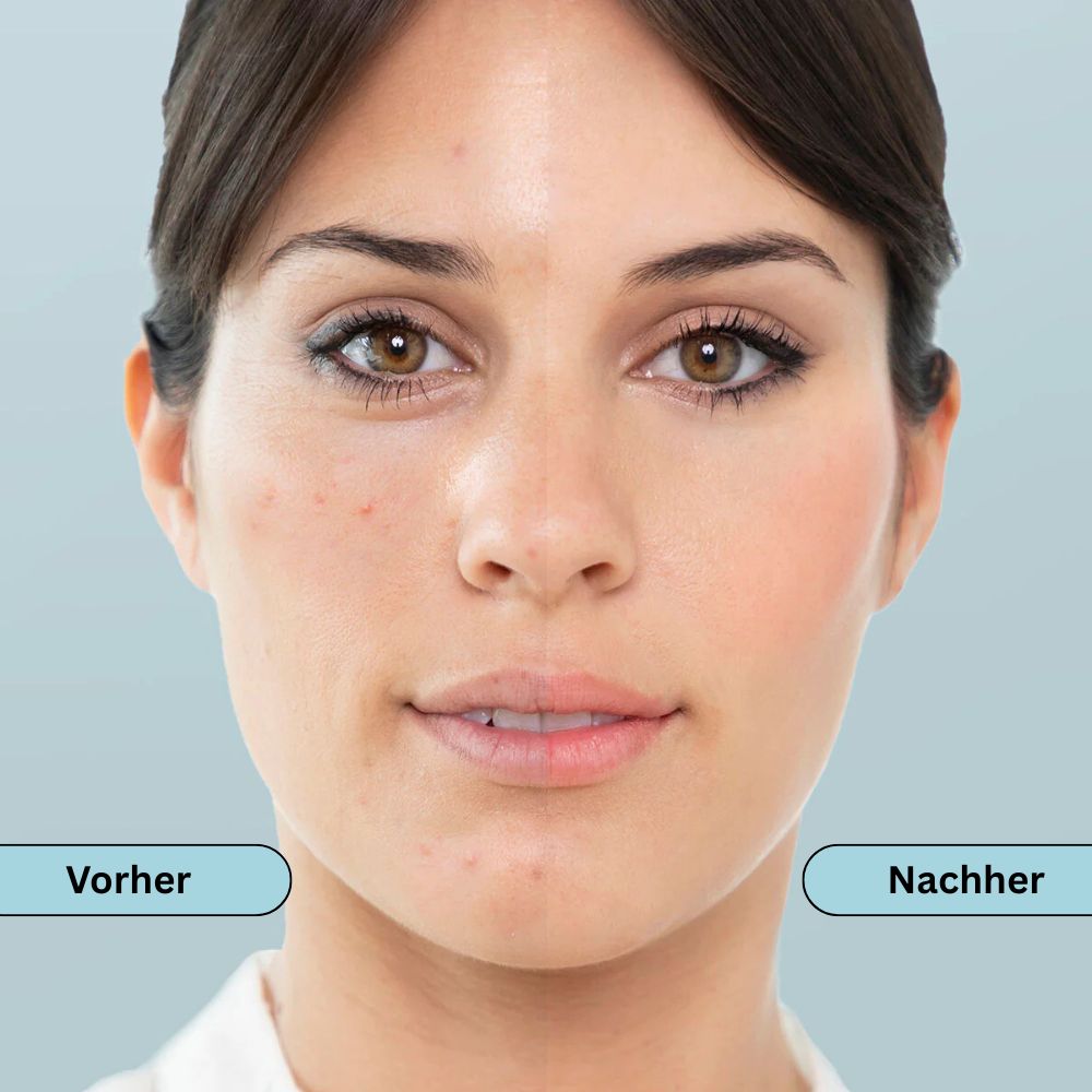 InnovaGoods | Moispa Elektrische Gesichtssauna
