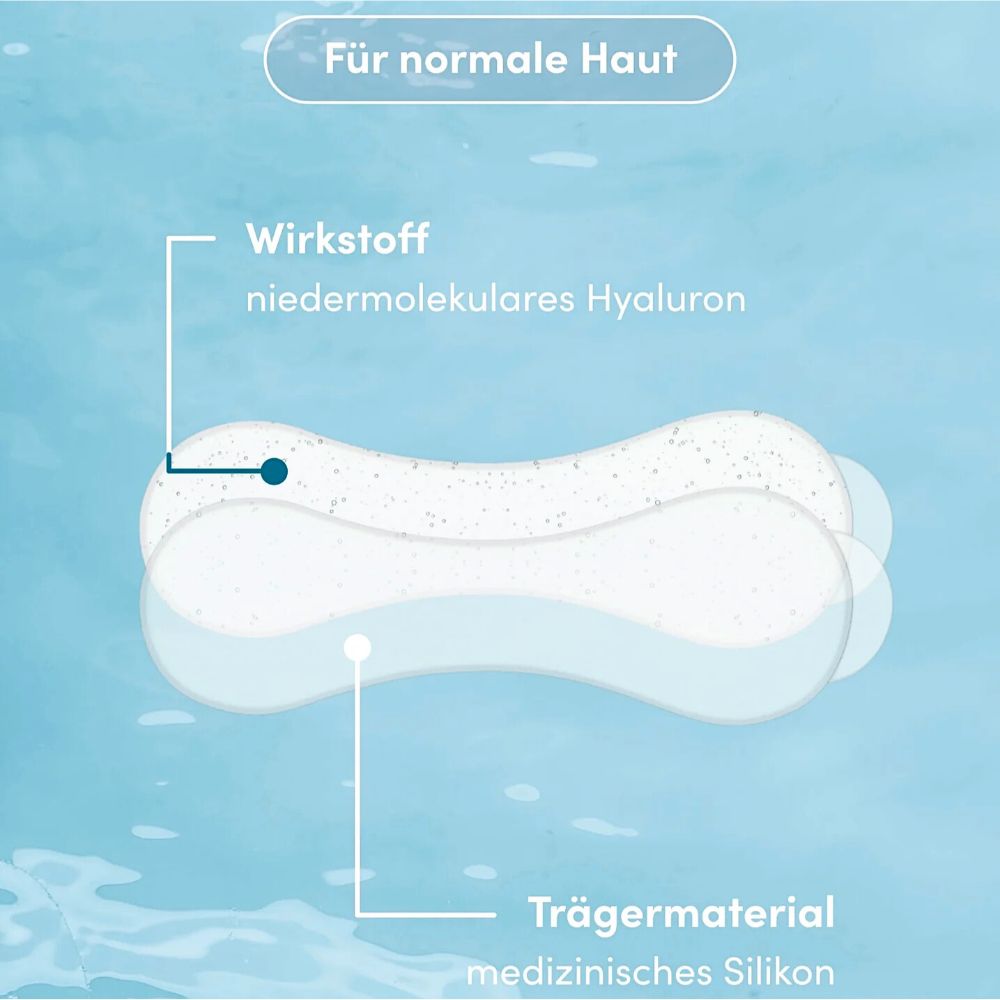 APRICOT I Mund Pads mit Hyaluron "I love your smile" - 30 Behandlungen
