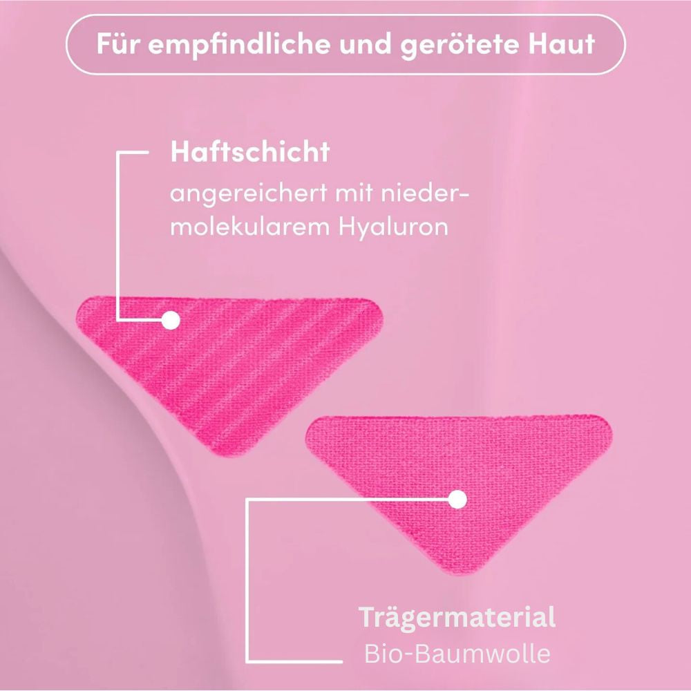 APRICOT I Zornfaltenpads mit Panthenol - 100 Behandlungen