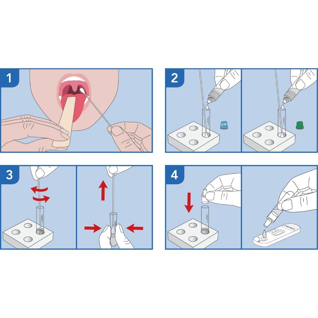 PRIMA | Strep A Home Test | Selbsttest zum Nachweis von ß-hämolytischen Gruppe-A-Streptokokken