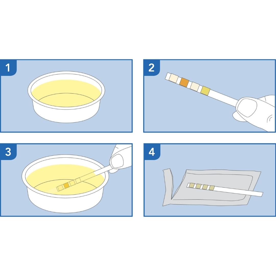PRIMA | Harnwegsinfektion Home Test | Selbsttest zum Nachweis von Leukozyten, Blut, Nitriten und Proteinen