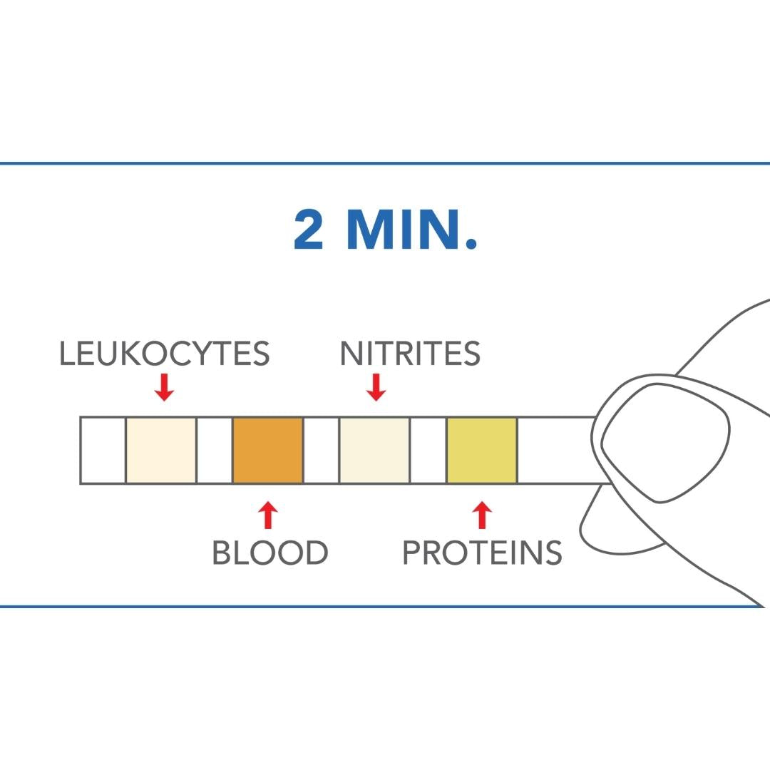 PRIMA | Harnwegsinfektion Home Test | Selbsttest zum Nachweis von Leukozyten, Blut, Nitriten und Proteinen
